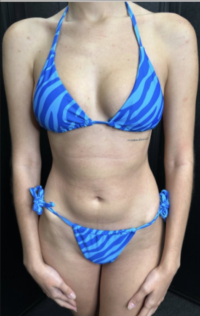Client before an organic spray tan at Slate