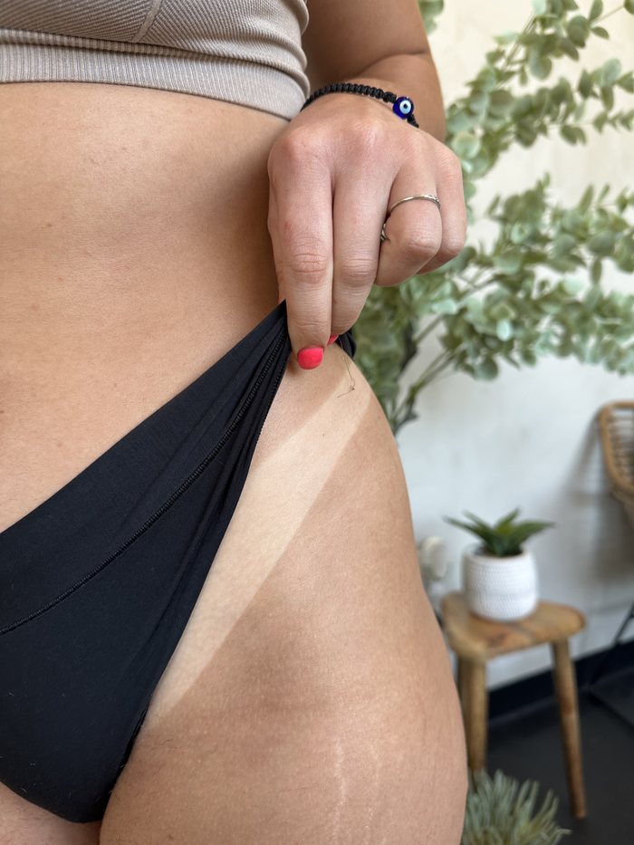 Spray tan result along the hip, showing an even natural colour line